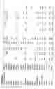 Fig. 30 - Identification of genes involved in angiogenesis, and development of an angiogenesis diagnostic chip to identify patients with impaired angiogenesis