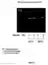 Fig. 10 - Methods for recovery of DNA from mRNA in ribosome display complexes
