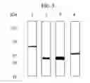 Fig. 05 - Thrombin-like recombinant baxtroxobin expressed by pichia sp.and production method thereof