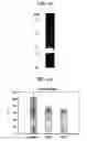 Fig. 08 - Thrombin-like recombinant baxtroxobin expressed by pichia sp.and production method thereof