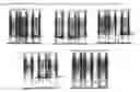 Fig. 27 - Globular adiponectin variants