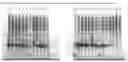 Fig. 29 - Globular adiponectin variants