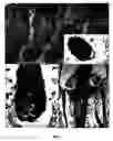Fig. 02 - Method of isolating epidermal neural crest stem cells