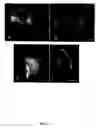 Fig. 03 - Method of isolating epidermal neural crest stem cells