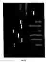 Fig. 11 - Method of isolating epidermal neural crest stem cells