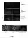 Fig. 20 - Method of isolating epidermal neural crest stem cells