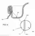 Fig. 14 - Metal interconnect for capacitor