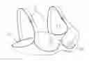 Fig. 01 - Mastectomy bras