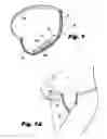 Fig. 02 - Adjustable undergarment
