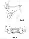 Fig. 04 - Adjustable undergarment