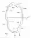 Fig. 04 - Tripot joint retainer