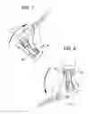 Fig. 05 - Golf glove for promoting swing accuracy