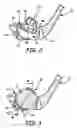 Fig. 03 - Ball throwing device