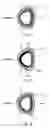 Fig. 06 - Muscle strength increasing tool