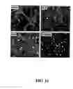 Fig. 11 - Compositions and methods for modulating angiogenesis