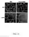 Fig. 13 - Compositions and methods for modulating angiogenesis