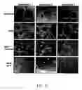 Fig. 16 - Compositions and methods for modulating angiogenesis
