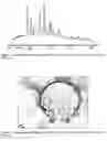 Fig. 08 - Crystalline (2E,4S)-4-[(N-{[(2R)-1-isopropylpiperidin-2-yI]-carbonyl}-3-methyl-L-valyl)(methyl)amino]-2,5-dimethylhex-2-enoic acid and its pharmaceutical uses
