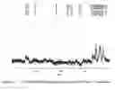 Fig. 29 - Crystalline (2E,4S)-4-[(N-{[(2R)-1-isopropylpiperidin-2-yI]-carbonyl}-3-methyl-L-valyl)(methyl)amino]-2,5-dimethylhex-2-enoic acid and its pharmaceutical uses
