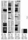 Fig. 08 - Methods and kits for diagnosing and treating b-cell chronic lymphocytic leukemia