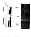 Fig. 32 - Method of treating or preventing pathologic effects of acute increases in hyperglycemia and/or acute increases of free fatty acid flux