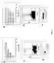 Fig. 35 - Method of treating or preventing pathologic effects of acute increases in hyperglycemia and/or acute increases of free fatty acid flux