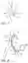 Fig. 08 - Implantable heart assist system and method of applying same