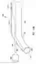 Fig. 17 - Apparatus and method for inserting an adjustable implantable genitourinary device