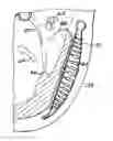 Fig. 01 - System, including method and apparatus for percutaneous endovascular treatment of functional mitral valve insufficiency