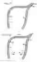 Fig. 07 - System, including method and apparatus for percutaneous endovascular treatment of functional mitral valve insufficiency