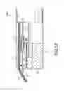 Fig. 12 - Endoscope