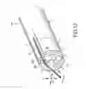 Fig. 17 - Endoscope