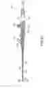 Fig. 22 - Endoscope