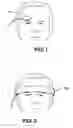 Fig. 02 - Forehead sensor placement