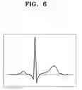 Fig. 09 - Apparatus and method for attaching biosignal measurement sensor to subject
