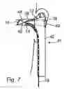 Fig. 05 - Device for measuring physical properties of the tympanic membrane