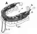 Fig. 01 - Oral device