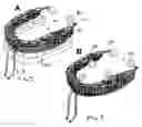 Fig. 03 - Oral device
