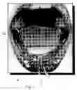 Fig. 04 - Oral device