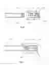 Fig. 04 - Guide-wire mounted balloon modulation device and methods of use
