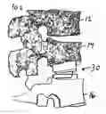 Fig. 01 - Customizing an intervertebral implant