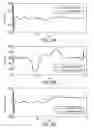 Fig. 11 - Feedback estimation of joint forces and joint movements