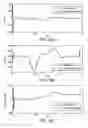 Fig. 15 - Feedback estimation of joint forces and joint movements