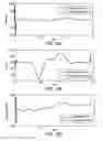 Fig. 19 - Feedback estimation of joint forces and joint movements