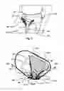 Fig. 04 - Brace for the proximal tibiofibular joint