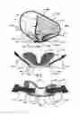 Fig. 05 - Brace for the proximal tibiofibular joint