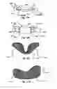 Fig. 06 - Brace for the proximal tibiofibular joint