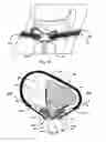 Fig. 08 - Brace for the proximal tibiofibular joint