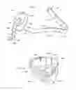 Fig. 04 - Wrist and elbow brace