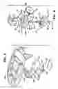 Fig. 06 - Infusion assembly that simultaneously delivers therapeutic fluid to plural body sites